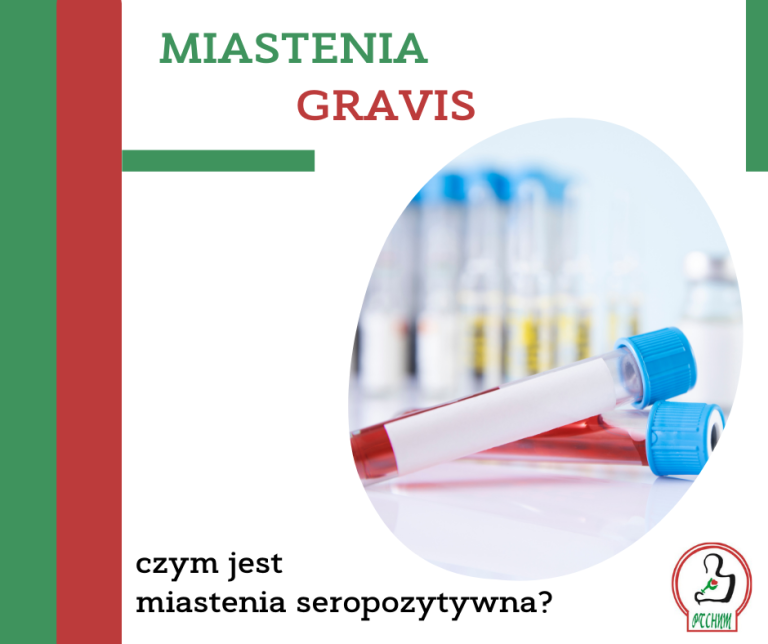 Miastenia - seropozywtywna