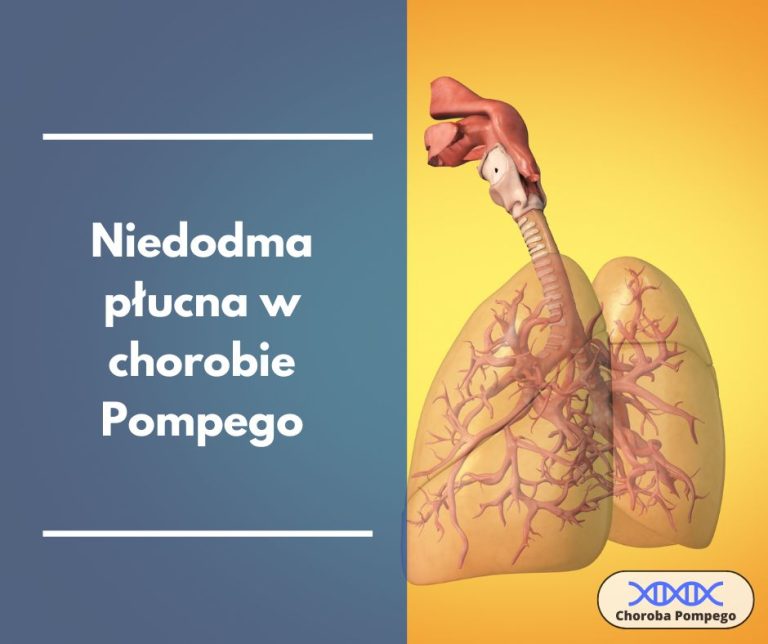 Choroba Pompego objawy niedoodma płucna