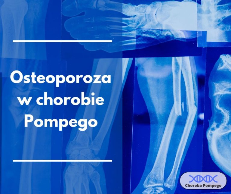 Osteoporoza w chorobie Pompego