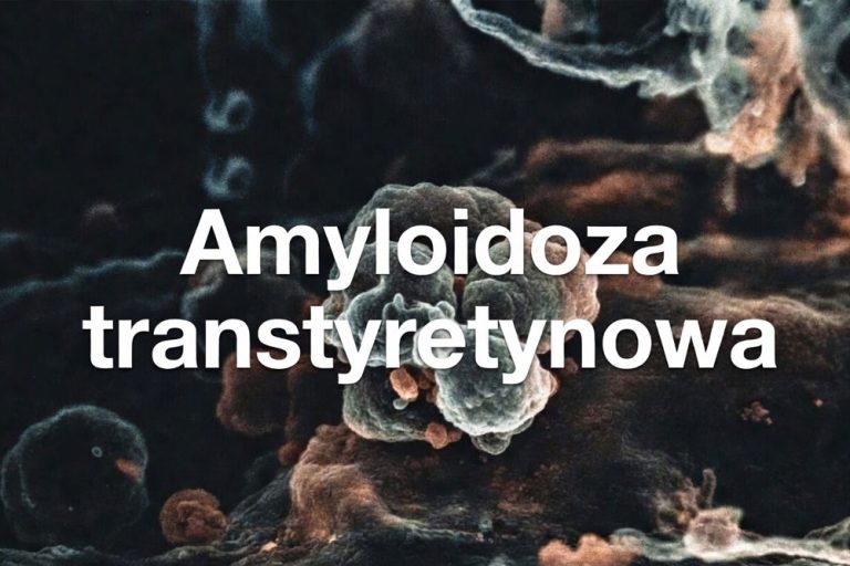 amyloidoza