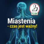 czas w leczeniu miastenii